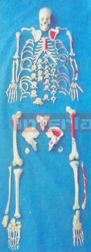 ADULT, LEFT MUSCLE ATTACHMENTS WITH PAINTS, FULL DISARTICULATED SKELETON (ARM/FOOT CONNECTED)